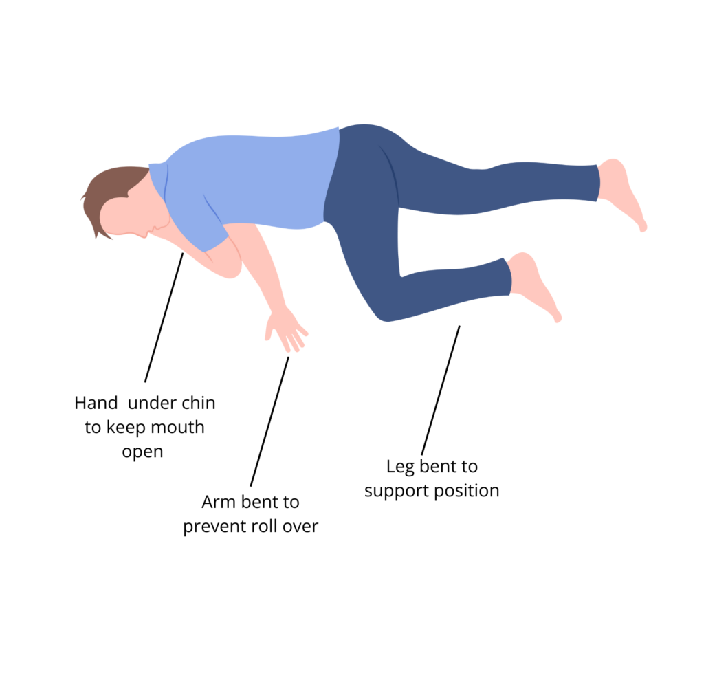 A picture of someone in recovery position
